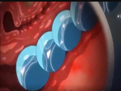 Thumbnail of post image 123