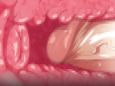 Thumbnail of post image 137