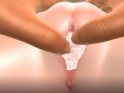 Thumbnail of post image 160