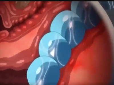 Thumbnail of post image 150